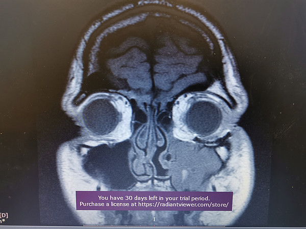 IMG_20211113_071806. 