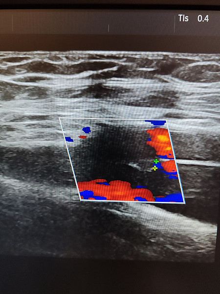 ������� 1. 