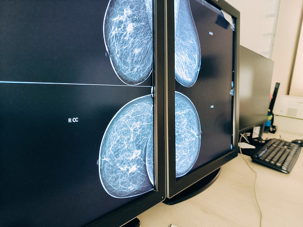 IMG_20250910_094925. 