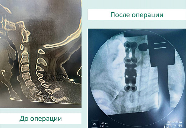 �� � �����. 