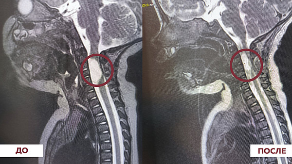 �������� �����. 