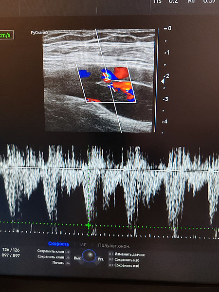 ������� 2. 